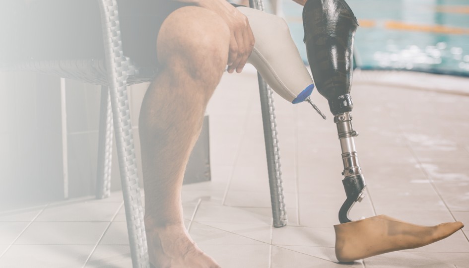 Amputee with a prosthetic leg.